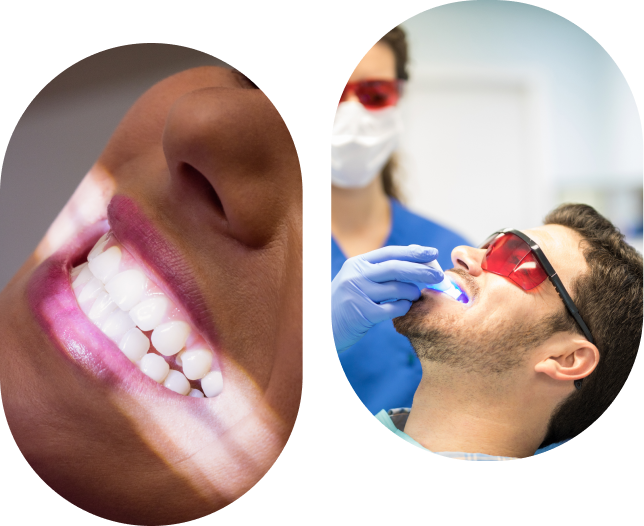 Image d'un patient souriant après un blanchiment dentaire professionnel