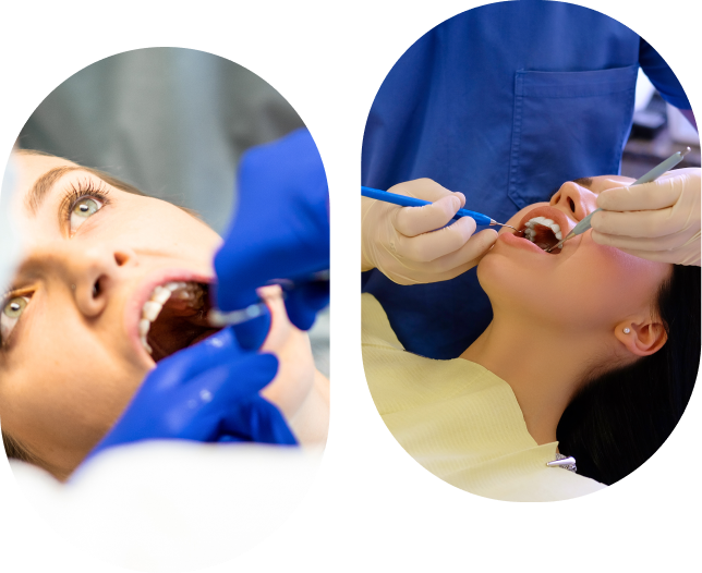 Image de gencives saines après un traitement parodontal