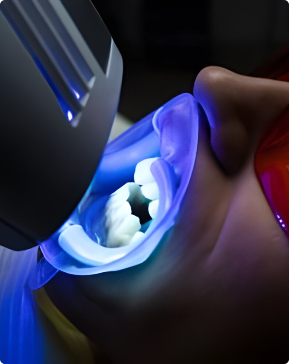 Image d'un patient avec des dents éclatantes après un traitement de blanchiment dentaire