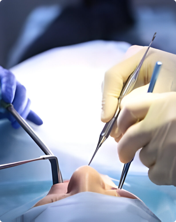 Image d'une intervention chirurgicale dentaire en cours, montrant un dentiste et son équipement