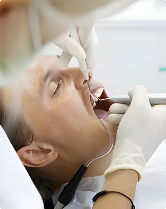 Image montrant un dentiste effectuant un nettoyage en profondeur des gencives