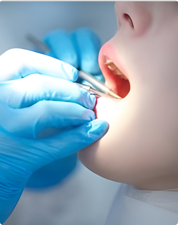 Gros plan sur des gencives guéries après un traitement de parodontie