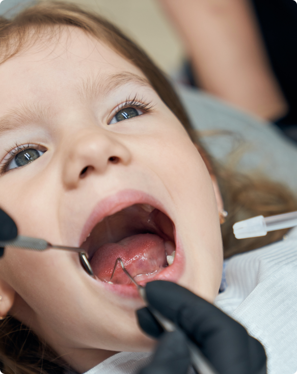 Image illustrant des soins dentaires préventifs pour les enfants