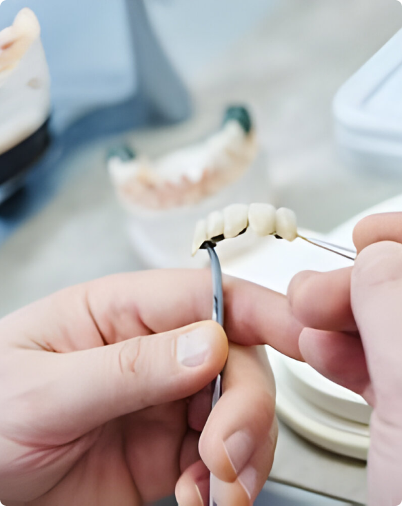 Image d'un dentiste préparant une prothèse dentaire pour un patient