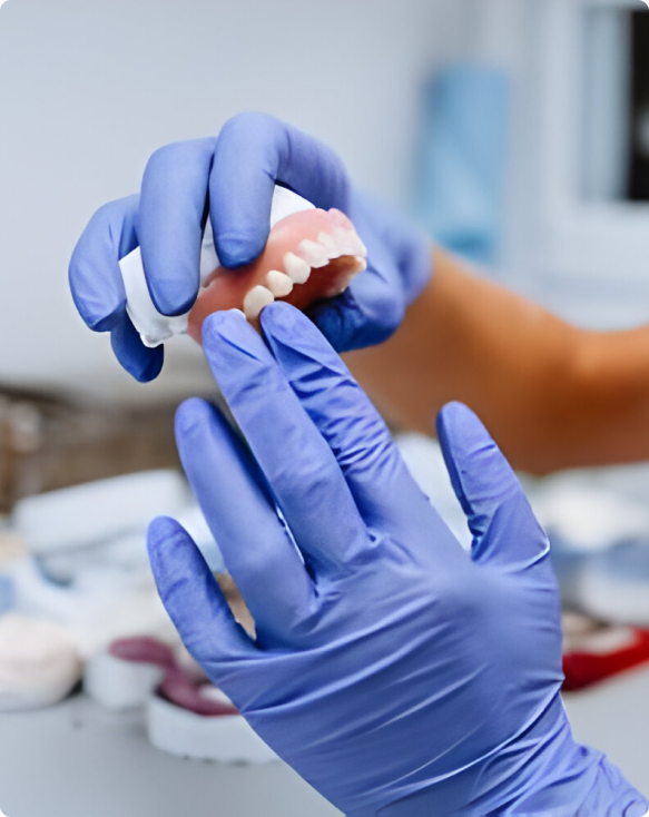 Image de prothèses dentaires complètes, montrant leur aspect naturel